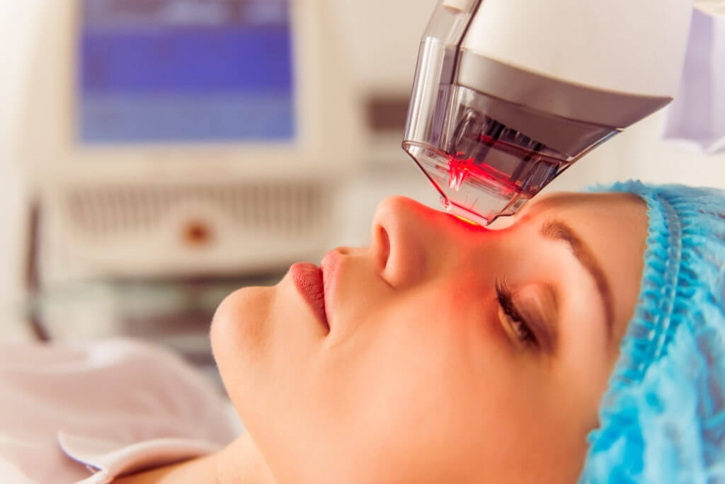 Laser treatment on the bridge of a woman's nose