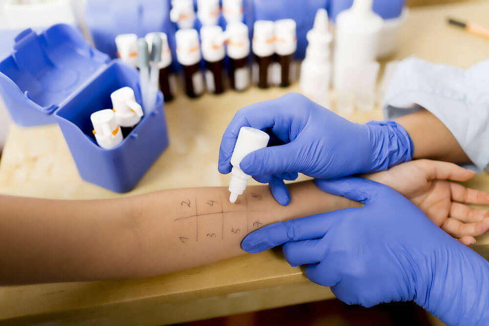 Person with blue gloves giving someone a skin allergy test